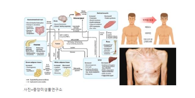 중앙미생물연구소, 건국대와 암 악액질 개선용 조성물 특허 기술이전 협약 썸네일